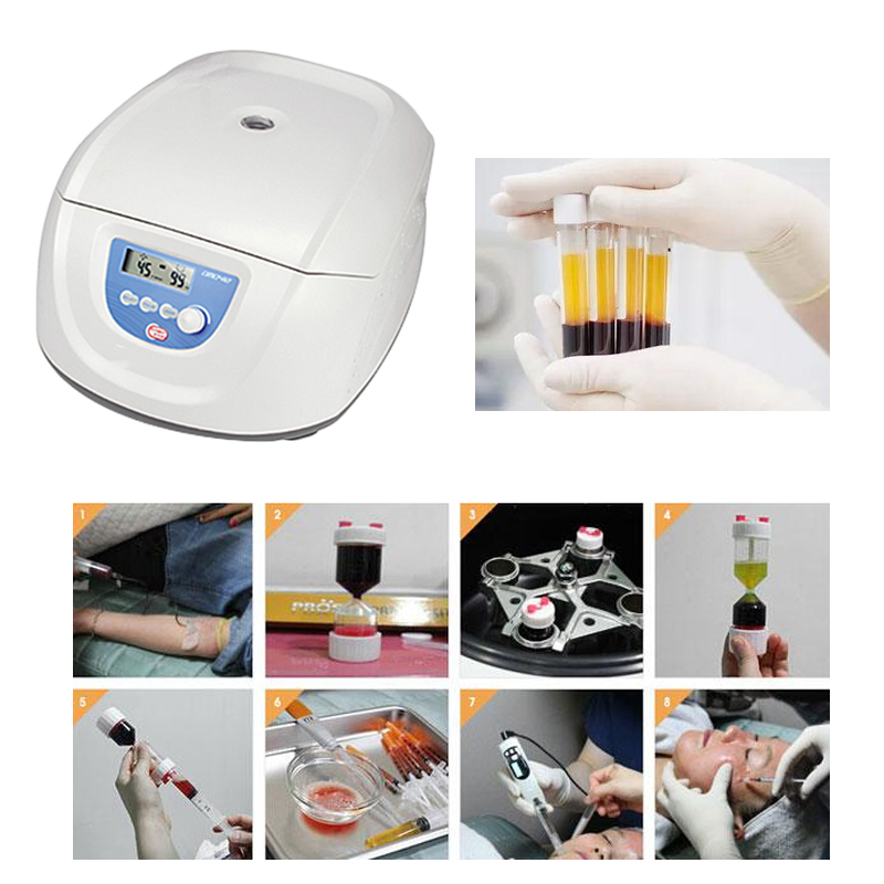 Best Seller Medical Blood PRP  - огляд і ціна Medical Lab Center